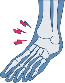 National Data Bank for Rheumatic Diseases
